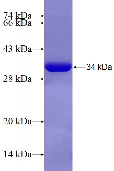 Recombinant Human THTPA SDS-PAGE