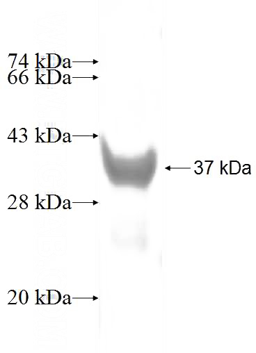 Recombinant Human VAMP1 SDS-PAGE