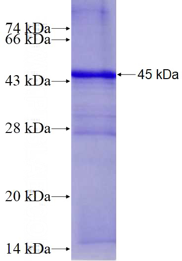 Recombinant Human CCNG2 SDS-PAGE