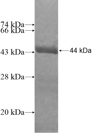 Recombinant Human HBG1 SDS-PAGE