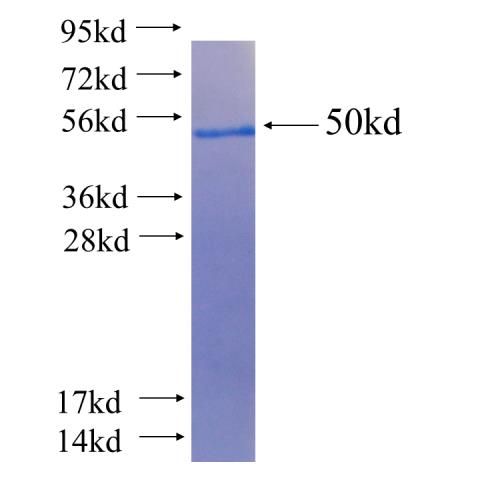 Recombinant human CLTA(Full length) SDS-PAGE
