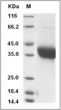 Human ADM / Adrenomedullin Protein (Fc Tag) SDS-PAGE