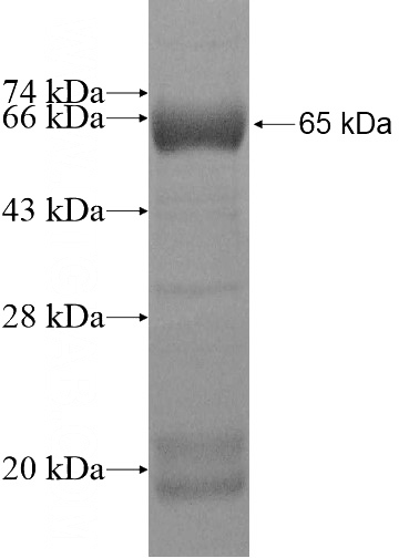 Recombinant Human SEC10 SDS-PAGE