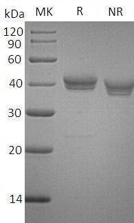 Human CADM3/IGSF4B/NECL1 (His tag) recombinant protein