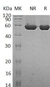 Human TINAGL1/GIS5/LCN7/OLRG2 (His tag) recombinant protein