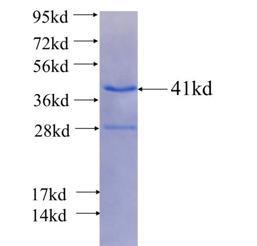 Recombinant human ABCC2 SDS-PAGE