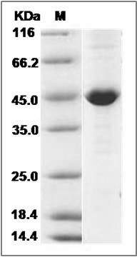Human CKB / Creatine kinase B type Protein (His Tag) SDS-PAGE