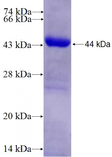 Recombinant Human ADRBK2 SDS-PAGE