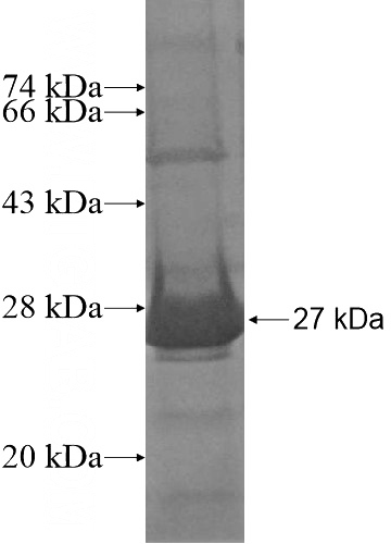 Recombinant Human RAB17 SDS-PAGE