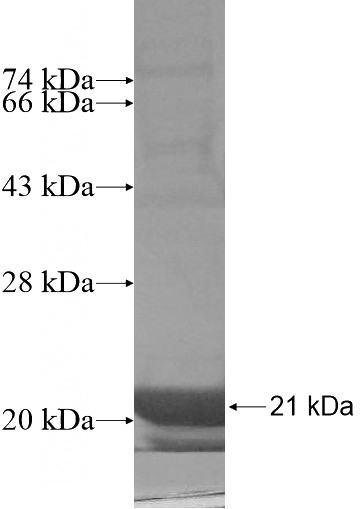 Recombinant Human TCL1B SDS-PAGE