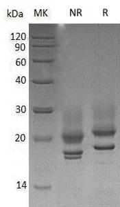 Human CD83 (His tag) recombinant protein