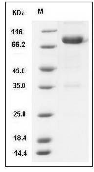 Mouse IL12B / IL-12B Protein (Fc Tag) SDS-PAGE