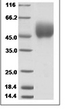 Human CD64/Fc gamma RI Protein 15336