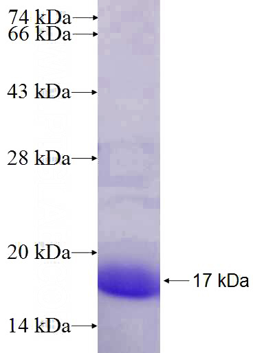 Recombinant Human KLF8 SDS-PAGE