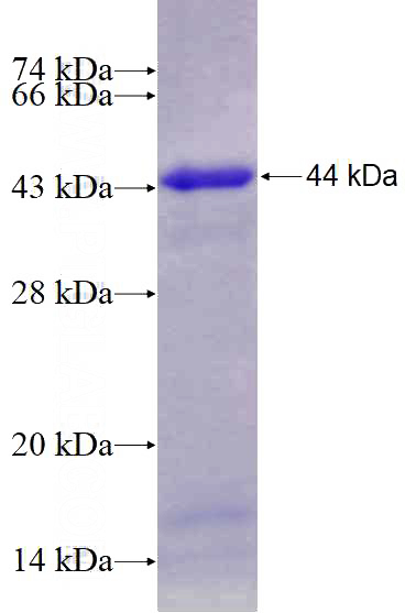 Recombinant Human RARA SDS-PAGE