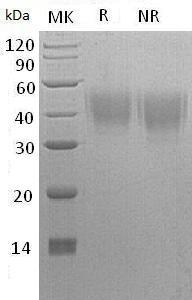 Human NPTN/SDFR1/SDR1 (His tag) recombinant protein