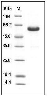 Human CD40 / TNFRSF5 Protein (His & Fc Tag) SDS-PAGE