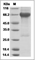 Human IGF1R / CD221 Protein (His & GST Tag)
