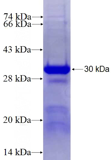 Recombinant Human HPN SDS-PAGE