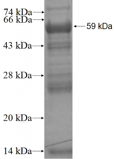 Recombinant Human ACRBP SDS-PAGE