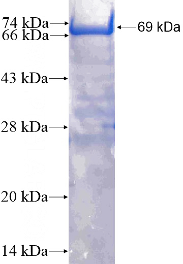 Recombinant Human BASP1 SDS-PAGE
