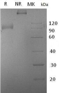 Mouse Il1rl1/Ly84/St2/Ste2 (Fc tag) recombinant protein