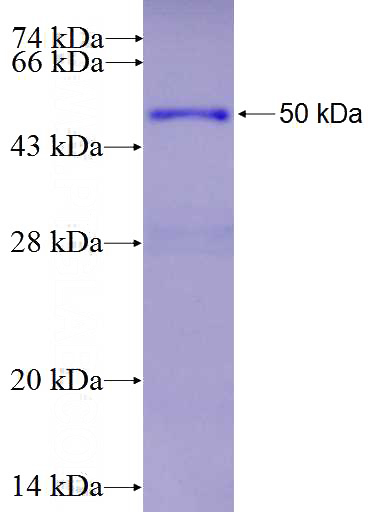Recombinant Human HOXB7 SDS-PAGE