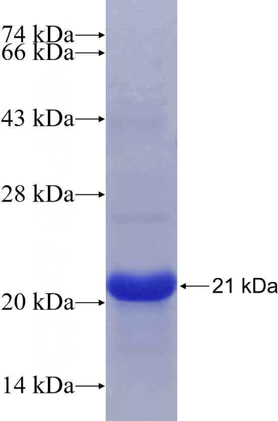 Recombinant Human LPL SDS-PAGE