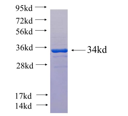 Recombinant human STARD3NL SDS-PAGE