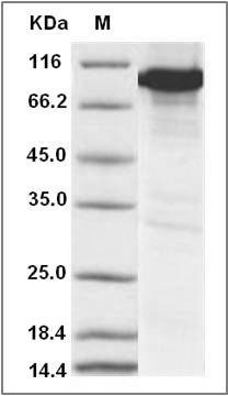 Mouse CAMK4 / CaMKIV Protein (His & GST Tag) SDS-PAGE