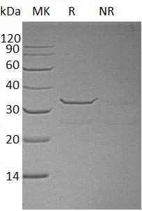 Human SULT1B1/ST1B2/SULT1B2 (His tag) recombinant protein