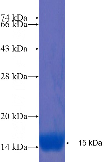 Recombinant Human FGD4 SDS-PAGE