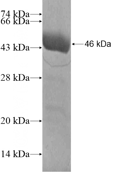 Recombinant Human ARHGEF15 SDS-PAGE