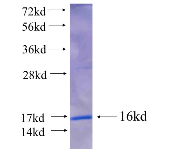 Recombinant human KDELC2 SDS-PAGE