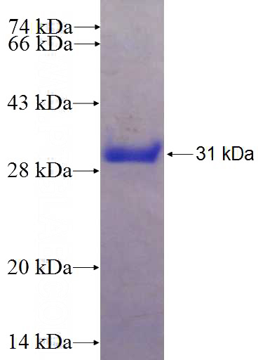 Recombinant Human SUNC1 SDS-PAGE