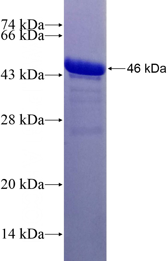 Recombinant Human HDAC9 SDS-PAGE