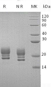 Human COQ7 (His tag) recombinant protein