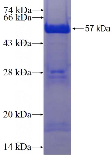 Recombinant Human KHDRBS3 SDS-PAGE