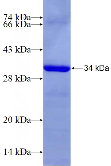 Recombinant Human RPS2 SDS-PAGE