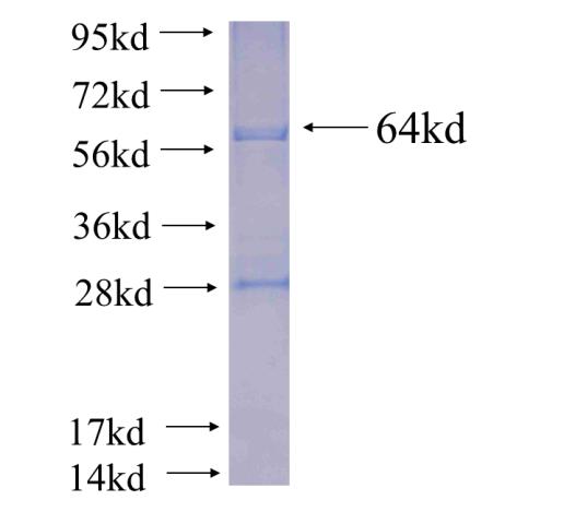 Recombinant human BDH1(Full length) SDS-PAGE