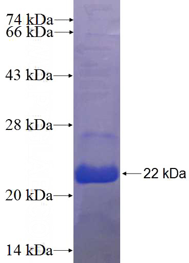 Recombinant Human ZNF333 SDS-PAGE