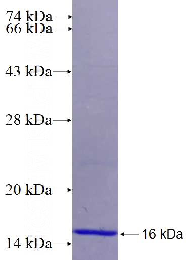 Recombinant Human RAB28 SDS-PAGE