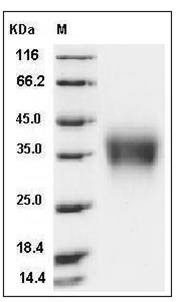 Rat CD32b / FCGR2B Protein (His Tag) SDS-PAGE