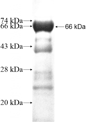 Recombinant Human RAB3IL1 SDS-PAGE