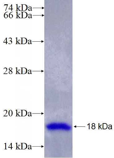 Recombinant Human ITGA2 SDS-PAGE