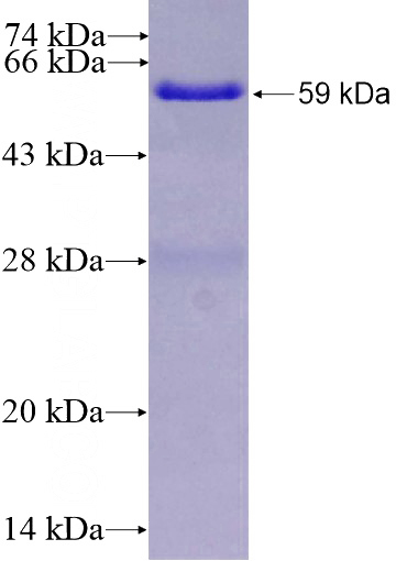 Recombinant Human FBXL15 SDS-PAGE