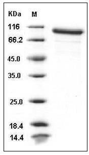Mouse MMP-9 Protein SDS-PAGE
