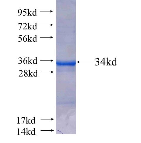 Recombinant human GSTO2(Full length) SDS-PAGE