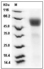 Rat IL1R1 / CD121a Protein (His Tag) SDS-PAGE