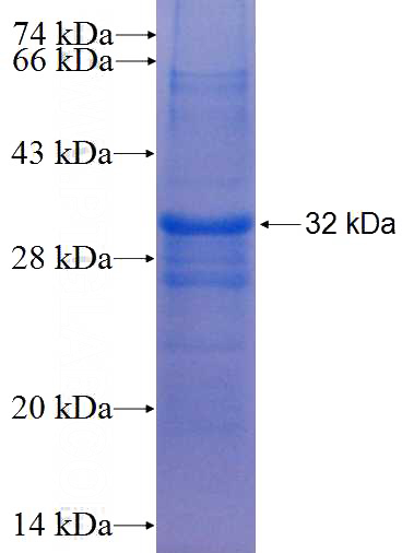 Recombinant Human MYCL1 SDS-PAGE